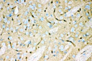 Anti- Aquaporin 4 Picoband antibody, IHC(P) IHC(P): Rat Brain Tissue (Aquaporin 4 抗体  (C-Term))