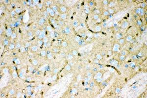 Anti- Aquaporin 4 Picoband antibody, IHC(P) IHC(P): Rat Brain Tissue