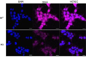 Immunocytochemical staining of HeLa cells using PIP5K1C antibody (ABIN7799794), 1:1,000), Top panel: wild-type (WT), Bottom panal: PIP5K1C shRNA knockdown (KD).