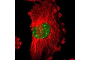 Immunofluorescent staining of U-251 MG with MYST4 polyclonal antibody  (Green) shows positivity in nucleus. (KAT6B 抗体)