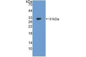 Detection of Recombinant NOSTRIN, Human using Polyclonal Antibody to Nitric Oxide Synthase Trafficker (NOSTRIN) (NOSTRIN 抗体  (AA 18-251))