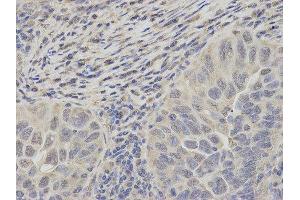 Immunohistochemistry (IHC) image for anti-Proteasome (Prosome, Macropain) 26S Subunit, ATPase, 2 (PSMC2) antibody (ABIN1874379) (PSMC2 抗体)