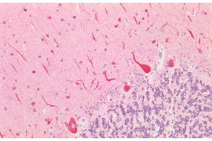 Detection of MAP1A in Human Purkinje cells of Cerebellum Tissue using Polyclonal Antibody to Microtubule Associated Protein 1A (MAP1A)
