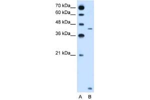 SLC46A3 antibody used at 2. (SLC46A3 抗体  (N-Term))