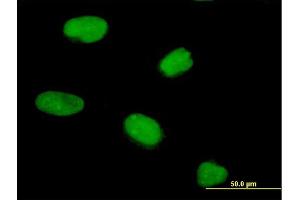 Immunofluorescence of purified MaxPab antibody to PRR6 on HeLa cell. (CENPV 抗体  (AA 1-275))