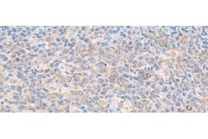 Immunohistochemistry of paraffin-embedded Human tonsil tissue using SMS Polyclonal Antibody at dilution of 1:70(x200) (SMS 抗体)