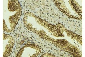ABIN6274371 at 1/100 staining Mouse colon tissue by IHC-P.