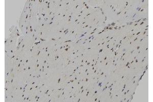 ABIN6267148 at 1/100 staining Mouse heart tissue by IHC-P. (NUMA1 抗体  (pThr2055))