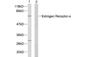 Western blot analysis of extracts from MCF7 cells using Estrogen Receptor-α (Ab-167) antibody (E021068). (Estrogen Receptor alpha 抗体)