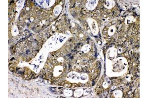 Immunohistochemistry (IHC) image for anti-Peptidylprolyl Isomerase A (Cyclophilin A) (PPIA) (AA 116-165) antibody (ABIN5518864)