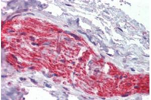 Nerve, Human: Formalin-Fixed, Paraffin-Embedded (FFPE) (Ankyrin G 抗体  (AA 1690-1701))