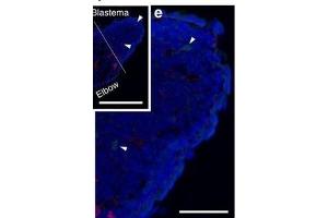 Immunofluorescence (Paraffin-embedded Sections) (IF (p)) image for anti-Collagen, Type IV (COL4) antibody (ABIN5596835)