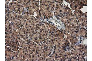 Image no. 2 for anti-Tubulin Folding Cofactor E-Like (TBCEL) antibody (ABIN1501326) (TBCEL 抗体)