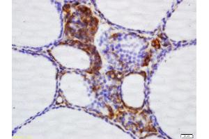 Formalin-fixed and paraffin embedded dog thyroid labeled with Rabbit Anti-NNT Polyclonal Antibody, Unconjugated (ABIN709631) at 1:200 followed by conjugation to the secondary antibody and DAB staining (NNT 抗体  (AA 981-1086))