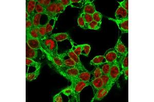 Immunofluorescence (IF) image for anti-Glypican 3 (GPC3) (AA 511-580) antibody (ABIN6939523)