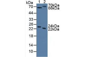Figure. (Mannose Associated Serine Protease 2 (AA 445-683) 抗体)