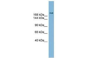 SETBP1 antibody used at 0. (SETBP1 抗体  (Middle Region))