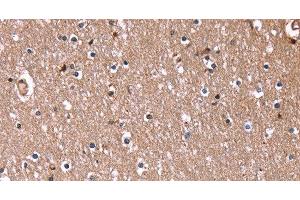 Immunohistochemistry of paraffin-embedded Human brain using RDX Polyclonal Antibody at dilution of 1:60 (Radixin 抗体)