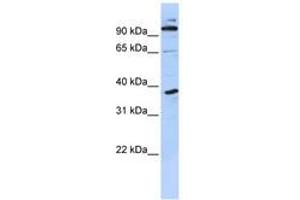 Image no. 1 for anti-PHD Finger Protein 11 (PHF11) (N-Term) antibody (ABIN6740584) (PHF11 抗体  (N-Term))