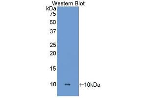 Western Blotting (WB) image for anti-Heparanase (HPSE) (AA 27-101) antibody (ABIN1173468) (HPSE 抗体  (AA 27-101))