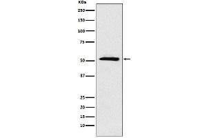 Western blot analysis of ETV6 expression in A431 cell lysate.