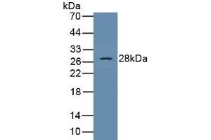 Detection of Recombinant SOCS1, Human using Polyclonal Antibody to Suppressors Of Cytokine Signaling 1 (SOCS1) (SOCS1 抗体  (AA 1-211))