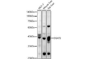 Western blot analysis of extracts of various cell lines, using DG antibody (ABIN6130268, ABIN6139559, ABIN6139561 and ABIN6218054) at 1:1000 dilution. (DGAT2 抗体  (AA 113-388))