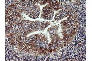 Image no. 9 for anti-Prefoldin Subunit 3 (PFDN3) antibody (ABIN1501704)