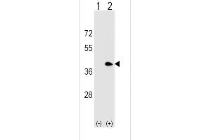 Western blot analysis of MS4A1 (arrow) using rabbit polyclonal MS4A1 Antibody (C-term) (ABIN1536862 and ABIN2848628). (CD20 抗体  (C-Term))