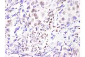 Immunohistochemistry (IHC) image for anti-PYD (Pyrin Domain) Containing 1 (PYDC1) (C-Term) antibody (ABIN7448421)