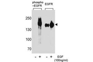 Western blot analysis of extracts from A431 cells, untreated or treated with EGF using phospho-EGFR antibody (left) or nonphos Ab (right). (EGFR 抗体  (pTyr1172))