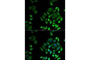 Immunofluorescence analysis of U2OS cell using PLA2G2D antibody. (PLA2G2D 抗体)