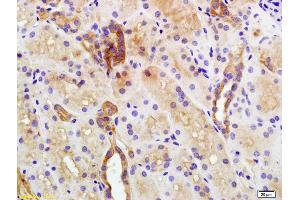 Formalin-fixed and paraffin embedded human kidney labeled with Anti-Plakophilin 2 Polyclonal Antibody, Unconjugated (ABIN1386389) at 1:200 followed by conjugation to the secondary antibody and DAB staining (Plakophilin 2 抗体  (AA 801-881))