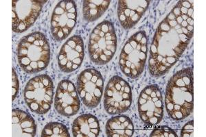 Immunoperoxidase of monoclonal antibody to CDH17 on formalin-fixed paraffin-embedded human colon. (LI Cadherin 抗体  (AA 24-131))