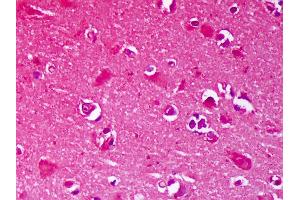 Anti-GRIN2B / NMDAR2B antibody IHC of human brain, cortex neurons.