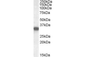 Image no. 1 for anti-Hydroxyacyl-CoA Dehydrogenase (HADH) (Internal Region) antibody (ABIN374901) (HADH 抗体  (Internal Region))