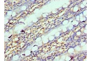 Immunohistochemistry of paraffin-embedded human colon tissue using ABIN7161635 at dilution of 1:100 (NPRL2 抗体  (AA 1-220))