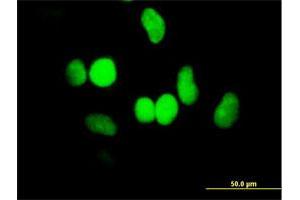 Immunofluorescence of purified MaxPab antibody to HELLS on HeLa cell. (HELLS 抗体  (AA 1-838))