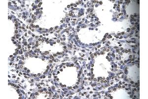 Human Lung; . (MYEF2 抗体  (Middle Region))