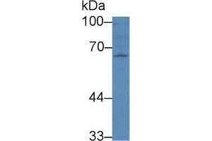 Detection of RANk in Human 293T cell lysate using Polyclonal Antibody to Receptor Activator Of Nuclear Factor Kappa B (RANk) (TNFRSF11A 抗体  (AA 359-542))
