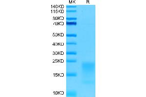 SDS-PAGE (SDS) image for Tumor Necrosis Factor Receptor Superfamily, Member 13C (TNFRSF13C) (AA 7-71) protein (His tag) (ABIN7273910)
