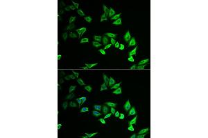 Immunofluorescence analysis of U2OS cells using MYOZ2 antibody. (MYOZ2 抗体)
