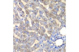 Immunohistochemistry of paraffin-embedded rat liver using FAH antibody at dilution of 1:100 (x40 lens). (FAH 抗体)