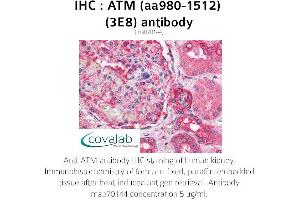 Image no. 1 for anti-Ataxia Telangiectasia Mutated (ATM) (AA 980-1512) antibody (ABIN1723092) (ATM 抗体  (AA 980-1512))