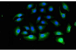 Immunofluorescent analysis of A549 cells using ABIN7142744 at dilution of 1:100 and Alexa Fluor 488-congugated AffiniPure Goat Anti-Rabbit IgG(H+L) (RPL13A 抗体  (AA 63-190))
