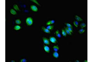 Immunofluorescent analysis of HepG2 cells using ABIN7158260 at dilution of 1:100 and Alexa Fluor 488-congugated AffiniPure Goat Anti-Rabbit IgG(H+L) (LILRA4 抗体  (AA 289-424))