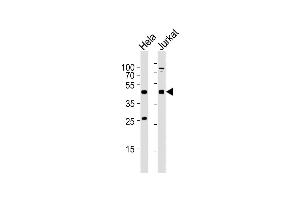All lanes : Anti-AVPR2 Antibody (C-term) at 1:2000 dilution Lane 1: Hela whole cell lysates Lane 2: Jurkat whole cell lysates Lysates/proteins at 20 μg per lane. (AVPR2 抗体  (C-Term))