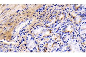 Immunohistochemistry (IHC) image for anti-Collagen, Type I, alpha 1 (COL1A1) (AA 253-471) antibody (ABIN7428014)