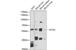 Western blot analysis of extracts of various cell lines, using  antibody (ABIN6129839, ABIN6136757, ABIN6136758 and ABIN6222179) at 1:1000 dilution. (ALAS2 抗体  (AA 50-320))