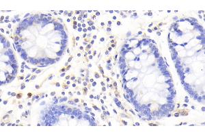 Immunohistochemistry (IHC) image for anti-S100 Calcium Binding Protein A12 (S100A12) (AA 1-92) antibody (ABIN7433135)